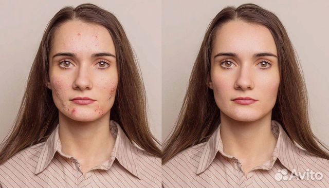 Фотошоп - ретушь, обработка фото